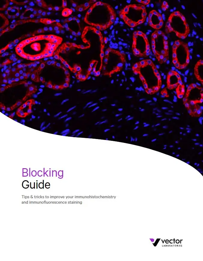 blocking guide cover 1