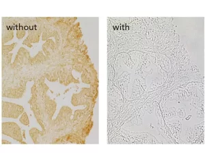 Prostate without and with R.T.U. Animal Free Block and Diluent used in the blocking step. Both sections are no primary antibody controls with Biotinylated Universal Secondary Antibody